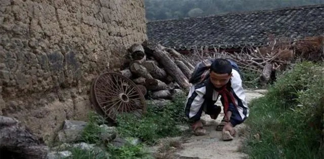 非洲埃塞俄比亚的“爬行村”：一代代的无奈，近亲结婚下的产物274 / 作者:刘moon / 帖子ID:130206
