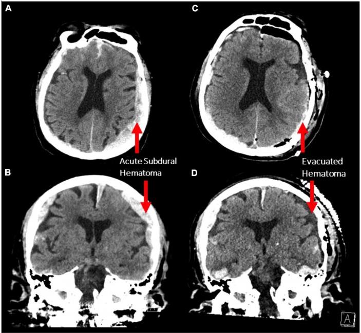科学家首次记录濒临死亡的人类大脑的活动 揭示类似梦境的活动970 / 作者:啵啵小奥特 / 帖子ID:130187 科学家首次记录濒临死亡的人类大脑的活动 揭示类似梦境的活动970 / 作者:啵啵小奥特 / 帖子ID:130187