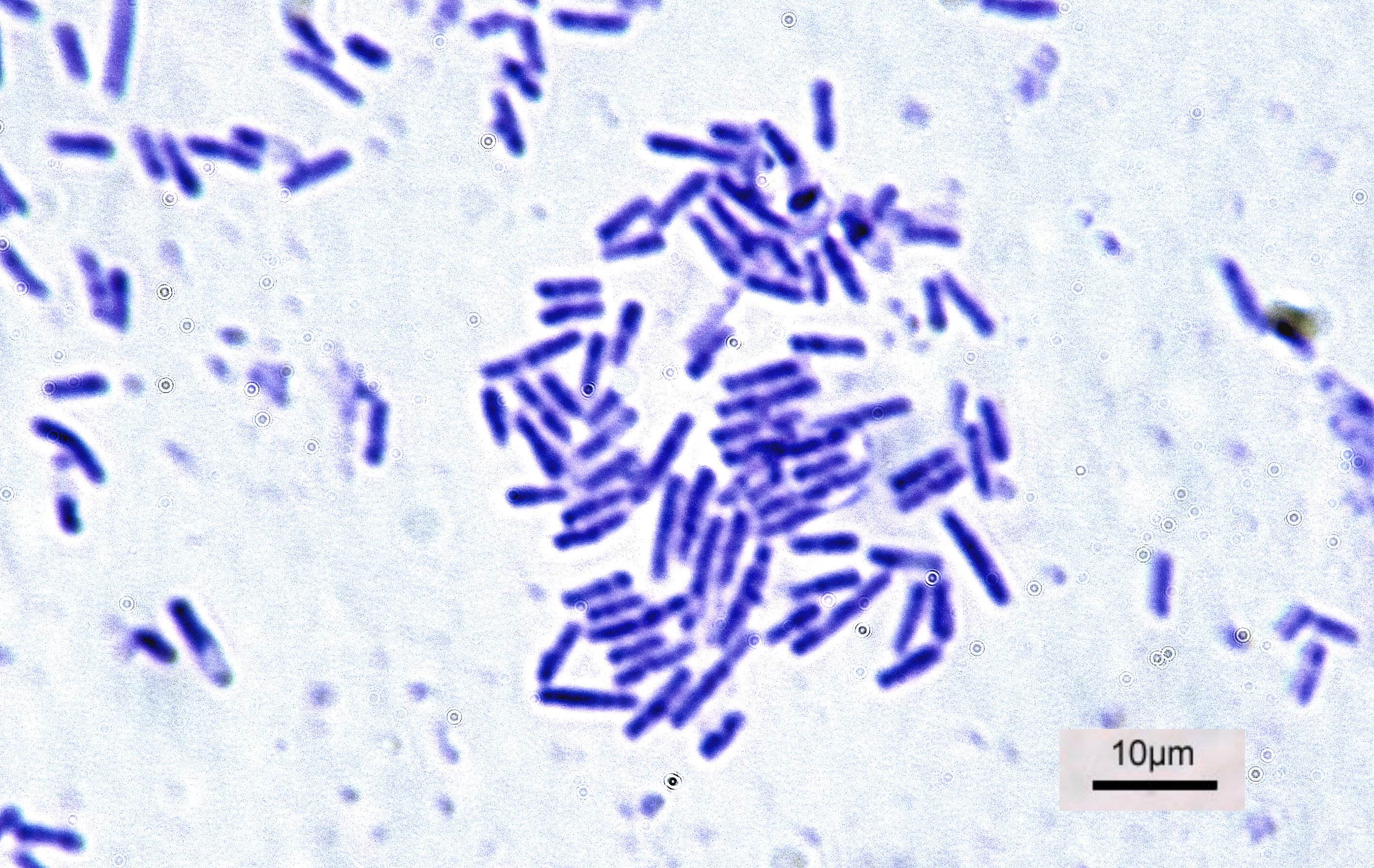 为了永生，科学家给自己注射350万年前的细菌，现在如何了？784 / 作者:绘粹凭 / 帖子ID:129913