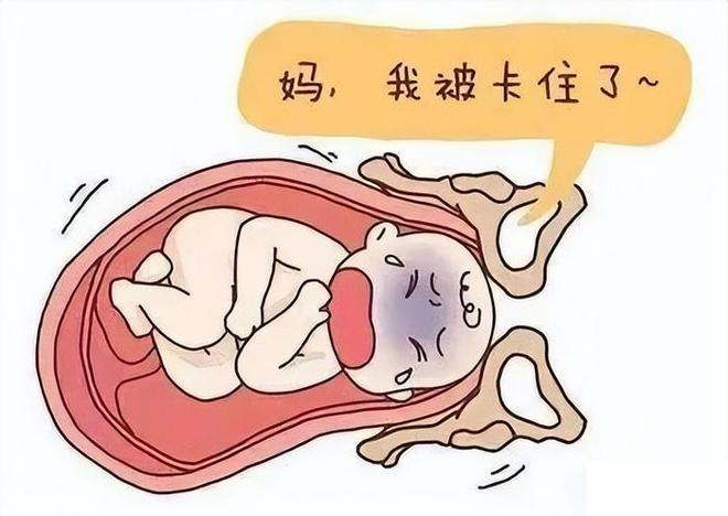 为什么动物分娩轻松而人类分娩痛苦？867 / 作者:单丁鹤纷 / 帖子ID:131005