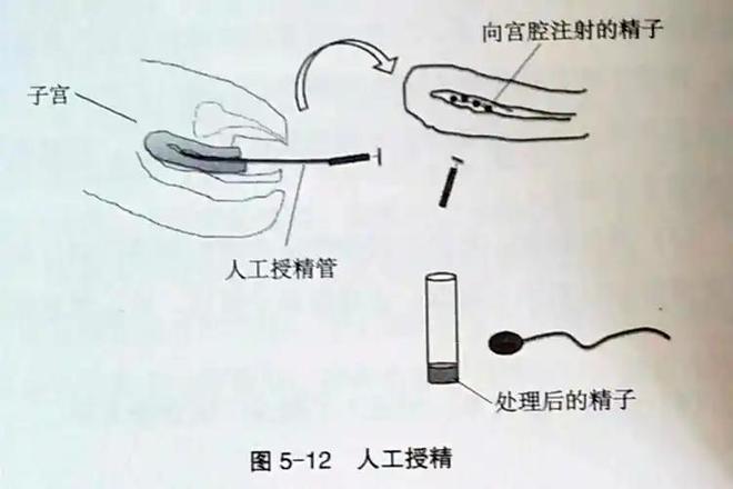 人类卵子体积远超精子千万倍，主动选择理想精子！245 / 作者:张立武 / 帖子ID:131170