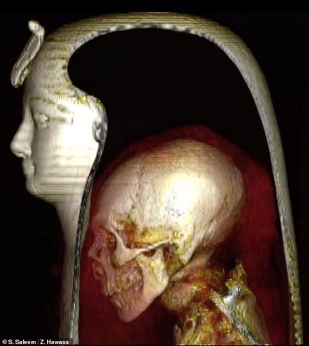 古埃及法老木乃伊首次通过CT扫描数字化拆封，揭示生前曾行割礼513 / 作者:张立武 / 帖子ID:131366