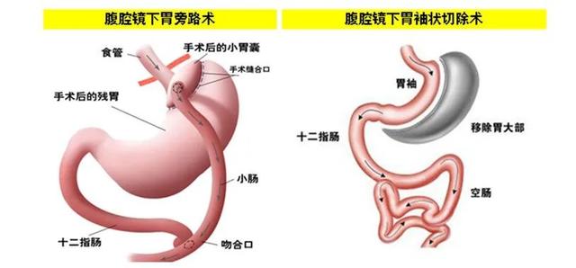 世界最胖的人_世界最胖的人3600斤图片视频36 / 作者:UFO爱好者 / 帖子ID:100266