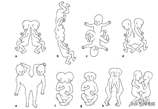 双头动物_双头动物图片958 / 作者:UFO爱好者 / 帖子ID:97688